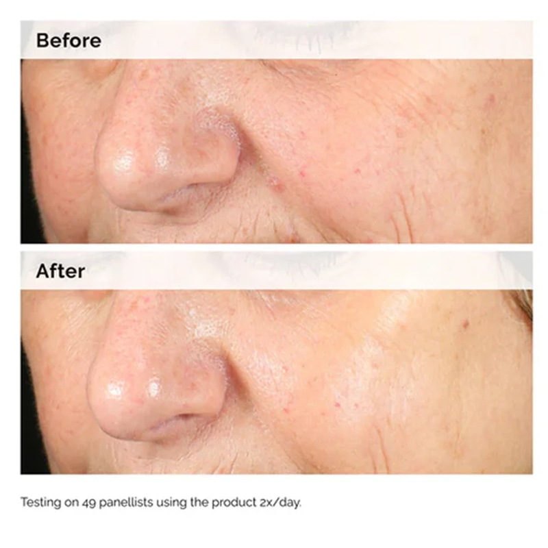 Alpha Arbutin 2% + HA 30ml Sie - Alpha Arbutin Serum recensione e prezzo