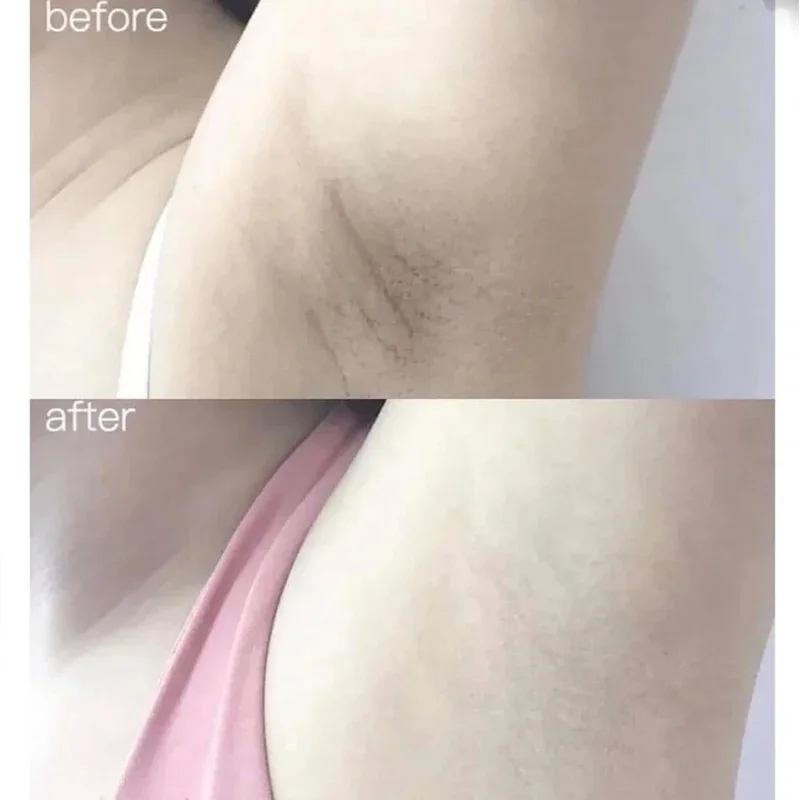 100ml Alpha Arbutina Collagene - Alpha Arbutin Serum recensione e prezzo